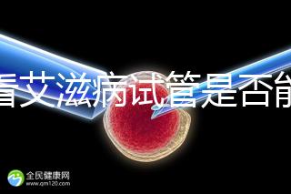 看看艾滋病試管是否能發現HCG大于150IU/ml或懷孕