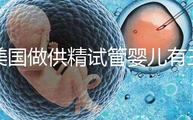 美國做供精試管嬰兒有三大條件，想知道需不需要結婚證戳