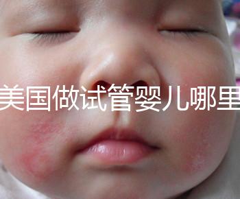 去美國做試管嬰兒哪里最好，4家好評輔助生殖機構推薦