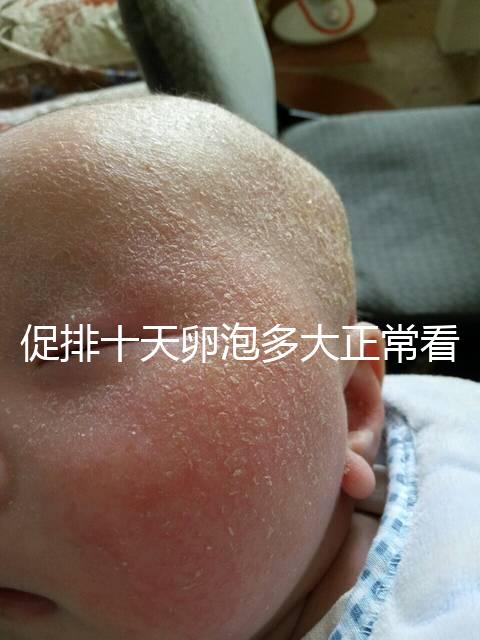 促排十天卵泡多大正常看這,1.1×0.9符不符合一文說(shuō)清