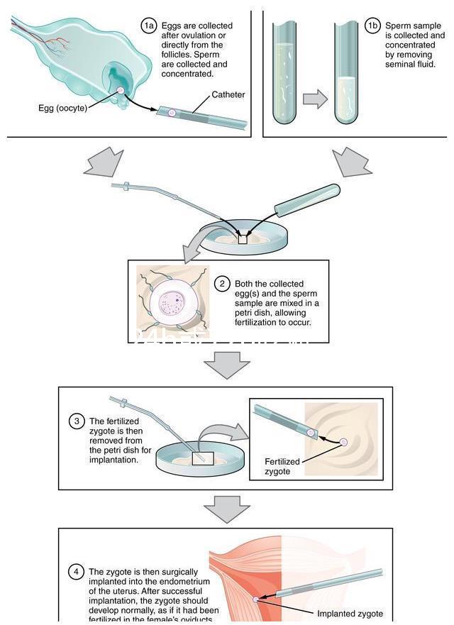 事后24h或72h吃避孕藥有效率真不高，一不小心容易中招