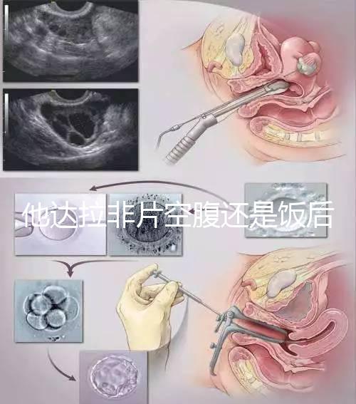 他達拉非片空腹還是飯后吃看這，控制好用藥時間效果佳