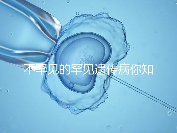 不罕見的罕見遺傳病你知道嗎？帶你認(rèn)識下特納綜合癥