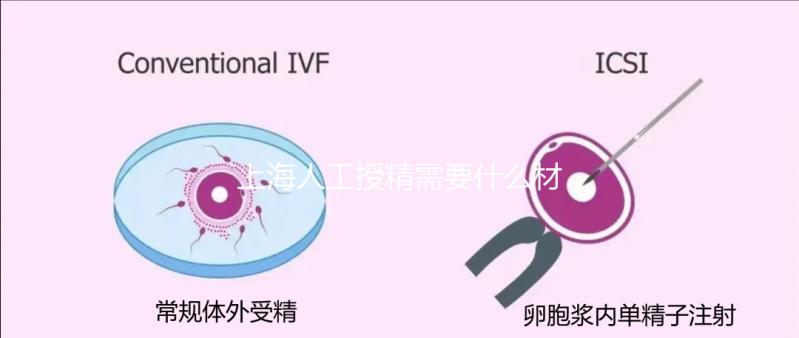 上海人工授精需要什么材料和手續戳，提前做好準備很重要