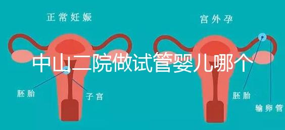 中山二院做試管嬰兒哪個醫(yī)生好？附醫(yī)院試管成功率