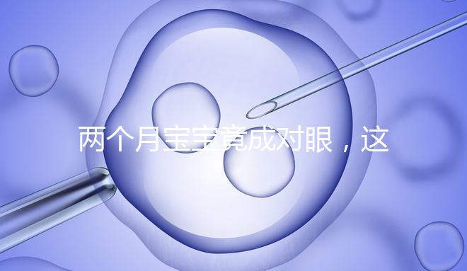 兩個月寶寶竟成對眼，這5大形成原因家長必知