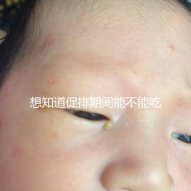 想知道促排期間能不能吃草莓看過來，怎么吃不發胖有講究