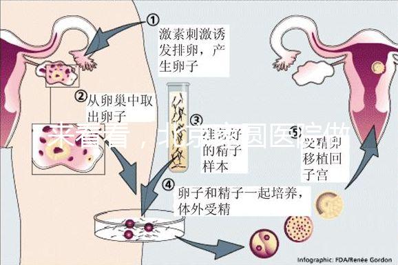 來看看，北京家圓醫(yī)院做三代試管費用總共多少？