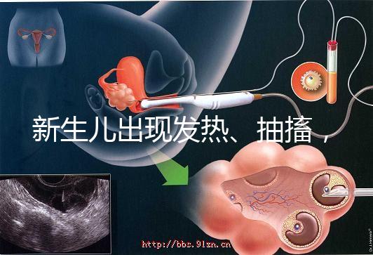 新生兒出現發熱、抽搐，很可能是胎毒的表現