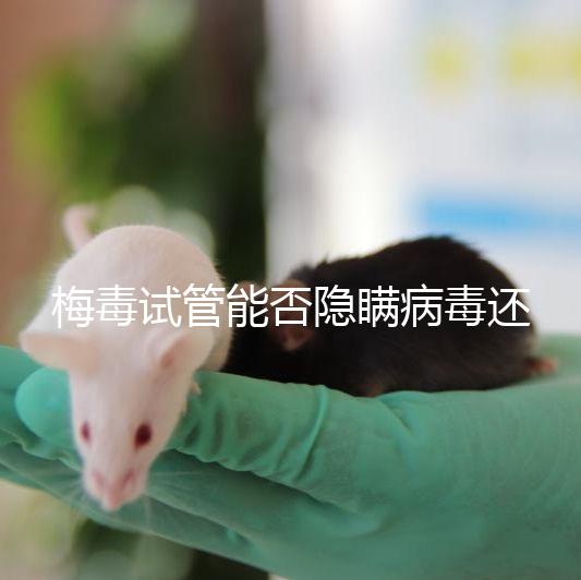 梅毒試管能否隱瞞病毒還沒有建造，備案記錄已經通知