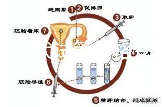 泰國三代試管價格變動，2025年最新費用行情一覽