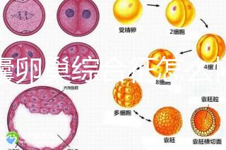 多囊卵巢綜合征怎么懷孕？試管嬰兒并不是唯一方案