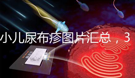 小兒尿布疹圖片匯總，3種類(lèi)型癥狀大不一樣