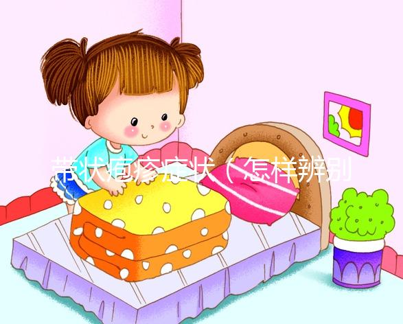 帶狀皰疹癥狀（怎樣辨別是不是帶狀皰疹）