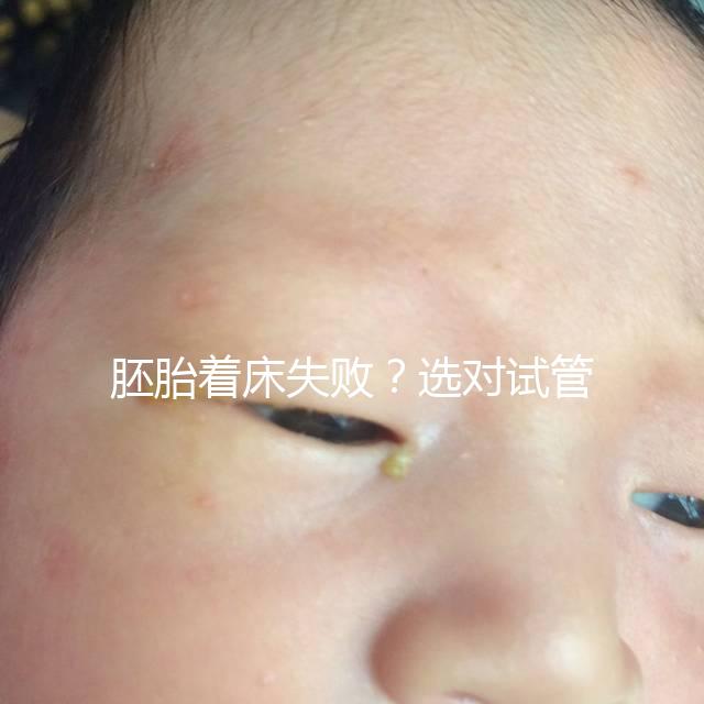 胚胎著床失敗？選對試管嬰兒醫生很重要