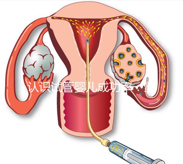 認(rèn)識(shí)試管嬰兒成功率:影響胚胎著床的胚胎因素