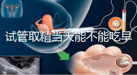 試管取精當天能不能吃早餐喝水的答案來咯咯，好不好一看就知道了？
