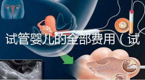 試管嬰兒的全部費用（試管嬰兒的全部費用大概是多少重慶安琪兒電話）