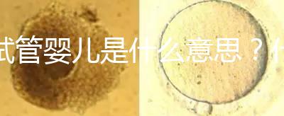 試管嬰兒是什么意思?什么是試管嬰兒?