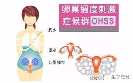 試管嬰兒要去醫院幾次（試管嬰兒要去醫院幾次？）