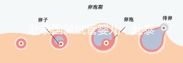 赴泰國做試管嬰兒（赴泰國做試管嬰兒要多少錢）