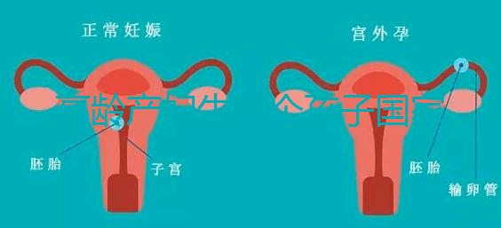 高齡產(chǎn)婦生八個孩子國家有補助？有沒有違法才是關(guān)鍵