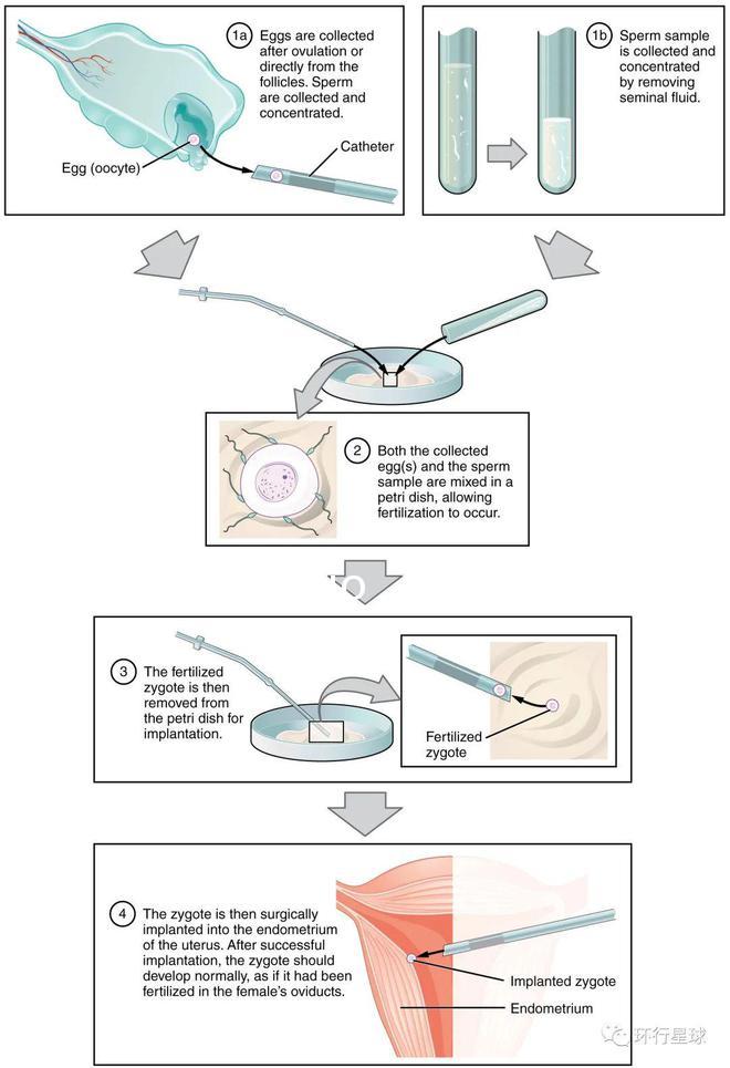 Reprod. Biomed：奇跡、突破、爭議、反思——“試管嬰兒”40年